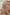 Woman with acne on her face, showing a close-up of blemishes, with text about skin problems and solutions. TR